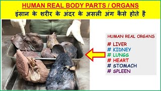 FullVideoHuman Real Body Parts  इंसान के शरीर के असली अंग कैसे होते है  Liver Kidney Lung Heart [upl. by Tigdirb]