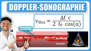 DopplerSonographie Blutfließgeschwindigkeit [upl. by Carly786]