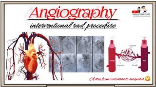 Angiography ArteriographyVenography Angiography radiological examination Angiography test [upl. by Ylellan]