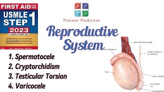 Spermatocele cryptorchidism testicular torsion from First Aid Reproductive system pathUrduHindi [upl. by Goeselt985]