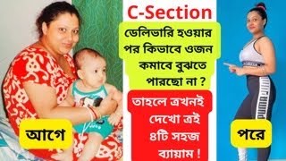 CSection ডেলিভারি হওয়ার পর পেট কমানোর জন্য ৪টি সহজ ব্যায়াম4 Exercises After CSection Delivery [upl. by Wamsley]