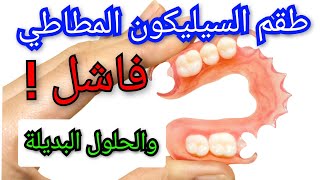 طقم الأسنان المطاطي المرن السيليكون فاشل ❗️إليكم البديل prothèse dentaire amovible Flexible [upl. by Ursuline]