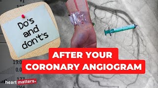 Post your coronary angiogram  What to know [upl. by Reena]