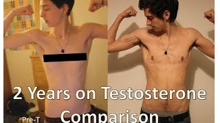 FTM nearly 2 years on Testosterone comparison [upl. by Alaik761]