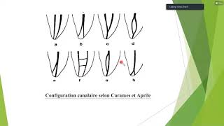 les lesions inflammatoires periapicales dorigine endodontique [upl. by Obediah]