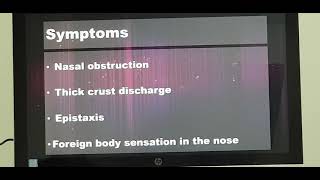 Atrophic rhinitis Part 1 English Patient teaching programme [upl. by Atteuqehs]