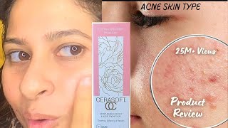 Acne skincare moisturiser  say goodbye 👋 to Dry skin cerasoft Beauteousskin moisturiser [upl. by Heywood712]