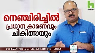 നെഞ്ചിരിച്ചിൽ പ്രധാന കാരണവും ചികിത്സയും  Acid reflux malayalam health tips [upl. by Innes]