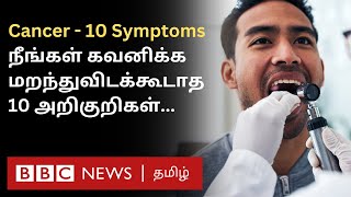 Cancer 10 Symptoms இதை சீக்கிரம் கவனிச்சிட்டா Treatment மூலம் குணப்படுத்திவிடலாம் [upl. by Thorr]