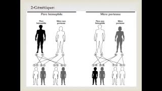 HEMATOLOGIE HEMOPHILIE [upl. by Aldous]