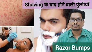 Shaving के बाद होने वाली फुंसीयाँ  Razor Bumps Treatment  Pseudofolliculitis Barbae razorbumps [upl. by Drew]