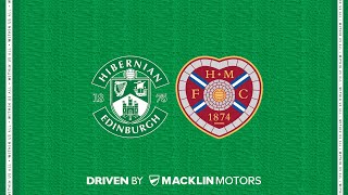 Hibernian vs Hearts  The Match BUILD UP  cinch Premiership [upl. by Sutit909]