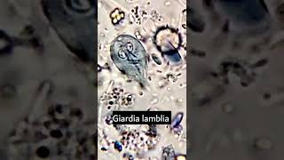 Giardia lambliaGiardiasis parasiteparasite under microscope microscopy parasitology [upl. by Nowell]