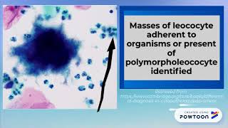 NILM Actinomyces 2018 [upl. by Korry485]