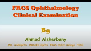 Clinical Ocular Examination  Part 2 Pupil Examination Part 2 amp Confrontation Test [upl. by Landan]