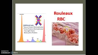 Multiple Myeloma Causes Symptoms Physiopathology Treatment USMLE NCLEX MCAT 3 minutes [upl. by Tipton703]