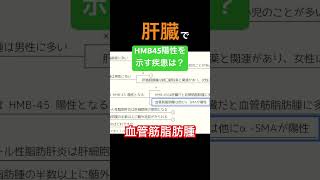 【消化器】肝臓でHMB45陽性を示す疾患は？ 細胞診 [upl. by Doowrehs]