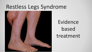 Restless Leg Syndrome evidence based treatment [upl. by Namilus]