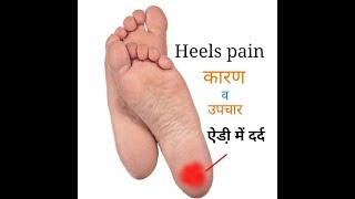 heel pain treatment  ऐडी़ में दर्द कारण एवं उपचार  heels painHindi [upl. by Ordnajela837]