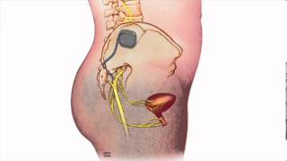 Fecal Incontinence  Heidi Chua MD  Mayo Clinic [upl. by Tamah]