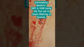 Intracellular Bacteria I GPC and GNB 8n Gram Staining of Sputum Mag 4000X [upl. by Nedak]