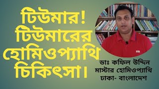 টিউমারের হোমিওপ্যাথি চিকিৎসা Tumour treatment in homeopathy [upl. by Ylrad]