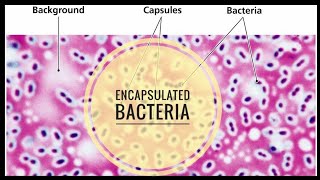 Encapsulated Bacteria [upl. by Ulises]