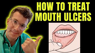 How to recognise and treat Mouth Ulcers getting rid of canker sores  Doctor ODonovan explains [upl. by Yanaj]