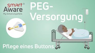 PEGVersorgung Pflege eines Buttons  Fachfortbildungen Pflege  Fortbildungen Pflege [upl. by Rodrigo]