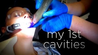 MY FIRST CAVITIES [upl. by Aikyn]