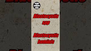 🤔Blastocystis Hominis en Heces Es un QuisteForma Vacuolar ¿Que es Morfologia e Identificacion🔬p2 [upl. by Ellon]