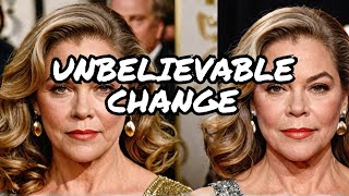 Kathleen Turner Then vs Now Stars Dramatic Transformation Revealed [upl. by Rennie803]