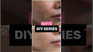 Diy Series DAY  2 ✨ TREAT DARK SPOTS shorts shortvideo short trending viral [upl. by Cory]