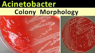 Acinetobacter Colony Morphology [upl. by Zulch]