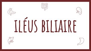 Sémiologie Chirurgicale  Iléus Biliaire [upl. by Hertberg]