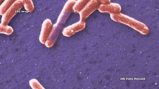 CarbapenemResistant Enterobacteriaceae CRE [upl. by Esilec]