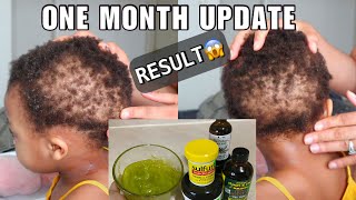 30 DAYS TODDLER HAIR GROWTH CHALLENGE RESULT Grow Your Childs Hair with Sulfur 8 Doo Gro and Oils [upl. by Sheridan]