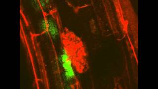 Arbuscular Mycorrhizal Symbiosis VESICLE Live Imaging [upl. by Giraldo]