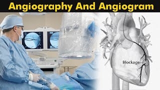 What is Angiography and Angiogram  How Angiography is performed 3D Animation [upl. by Notnarb448]