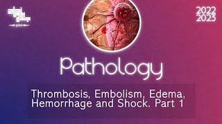 L11 part1 Thrombosis Embolism edemahemorrhage and shock Pathology [upl. by Aneris]