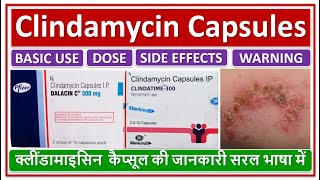 Clindamycin Capsules क्लींडामाइसिन कैप्सूल की जानकारी सरल भाषामें Dose Use Side effect Warning [upl. by Loughlin]