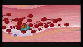 Transglutaminase in blood coagulation Factor XIIIa FXIIIa Crosslinking of fibrin [upl. by Meeker770]