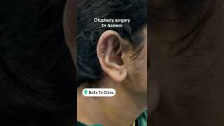 Otoplasty surgery in Pakistan lahore by dr Saleem otoplastysurgery [upl. by Rundgren74]