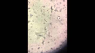 Giardia Lamblia trophozoite [upl. by Felipa]