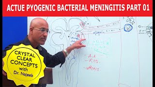 Acute Pyogenic Bacterial Meningitis Part 1 🩺 [upl. by Homovec580]