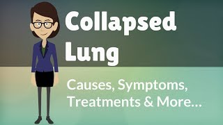 Collapsed Lung  Causes Symptoms Treatments amp More… [upl. by Raynor420]