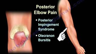 ELBOW PAIN  COMMON CAUSES  Everything You Need To Know  Dr Nabil Ebraheim [upl. by Nnylf937]