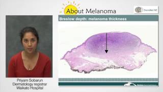 Melanoma Pathology Report [upl. by Verlie993]