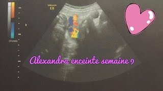 Alexandra enceinte  semaine 9 [upl. by Ilyk]