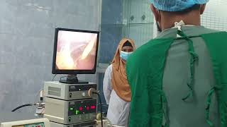 Laparoscopic Cholecystectomy Dr Akiv Dr Shadin 08072024 [upl. by Somisareg]